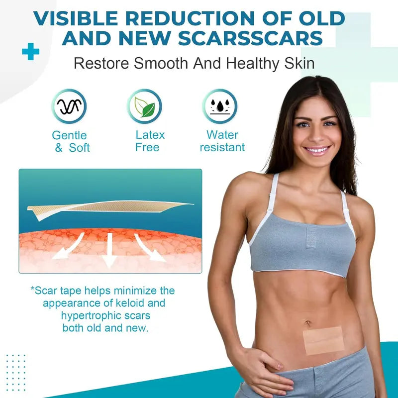 Beauty Patch | Silicone Scar Tape